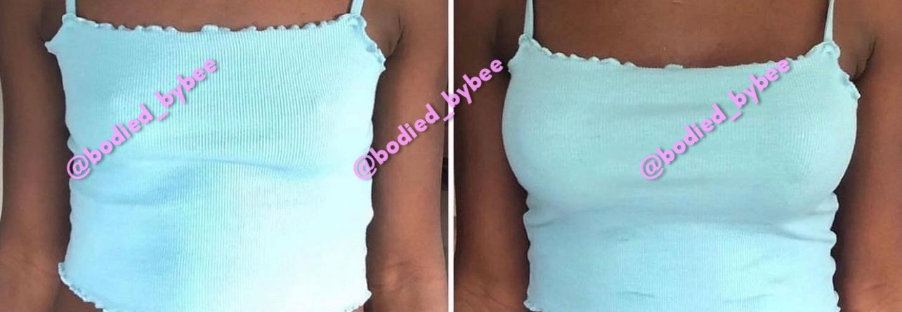 Breast enlargement oil - Image 2